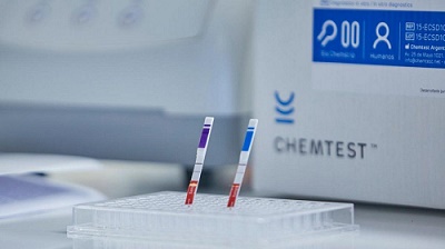 Aprobaron el primer test rápido para detectar coronavirus en casa: cómo funciona